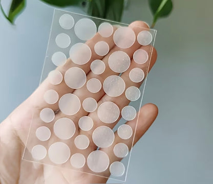Pimple Patches – Hydrocolloid Acne Spot Treatment Stickers