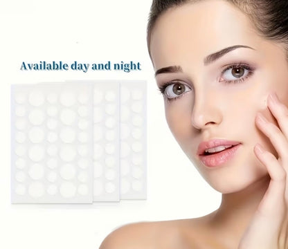 Pimple Patches – Hydrocolloid Acne Spot Treatment Stickers